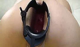 Gaping Anal Speculum Stretching And Dildo Fuck